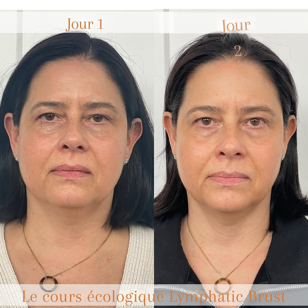 Lymphatic Contour Face Brush®