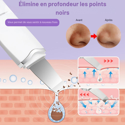 Kit de nettoyage du visage à ultrasons®