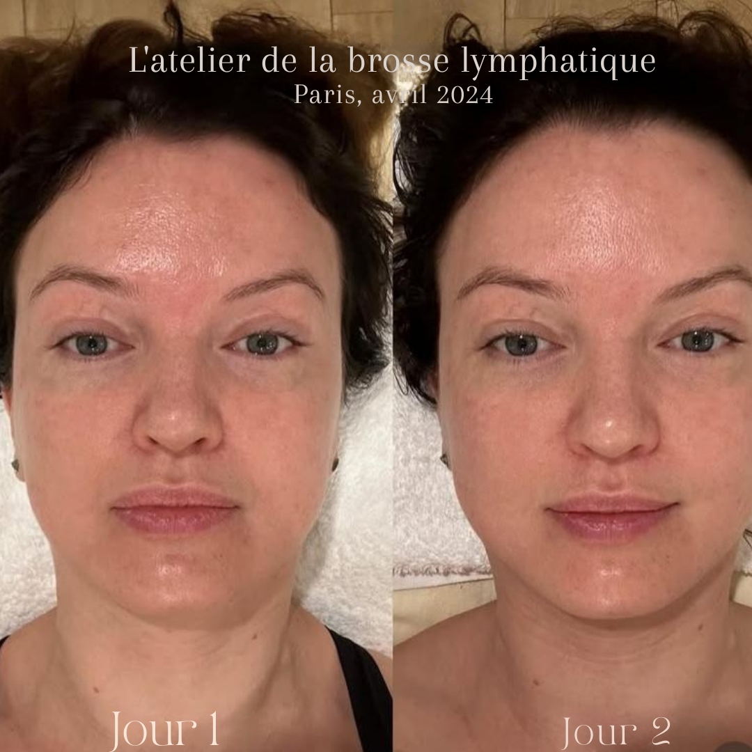 Lymphatic Contour Face Brush®