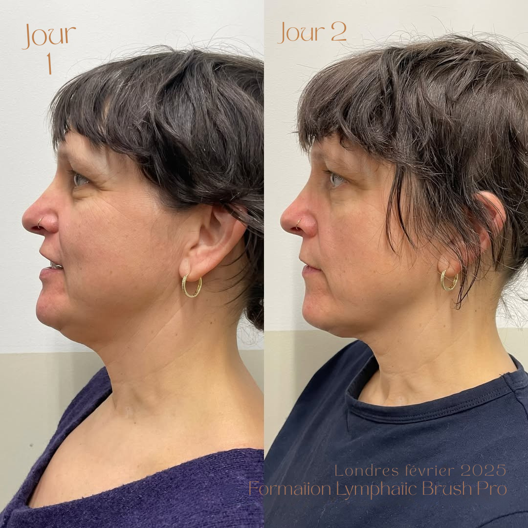 Lymphatic Contour Face Brush®