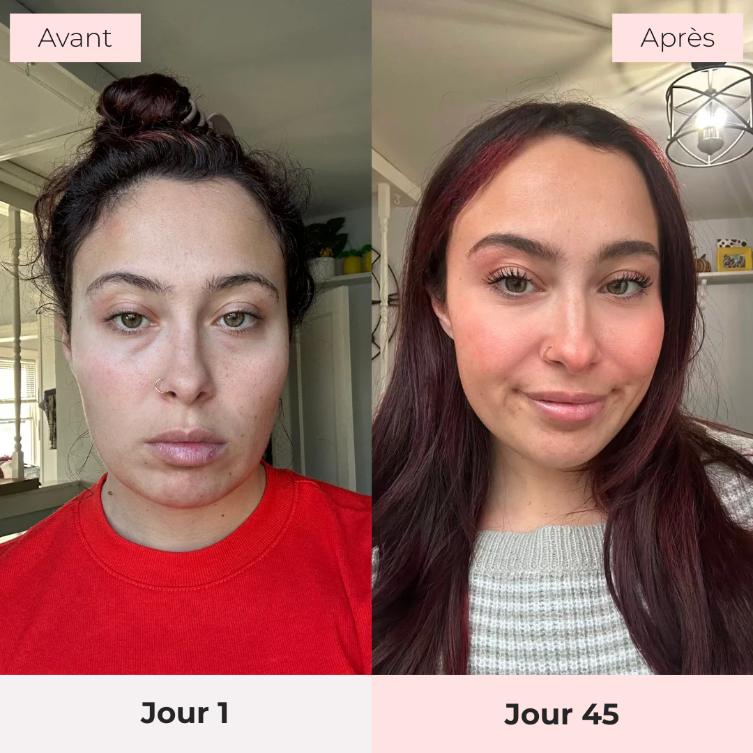 RevitalEyes