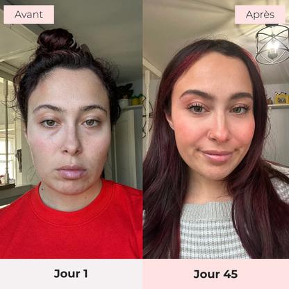 RevitalEyes