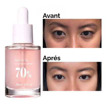 Sérum Niacinamide Pêche 70