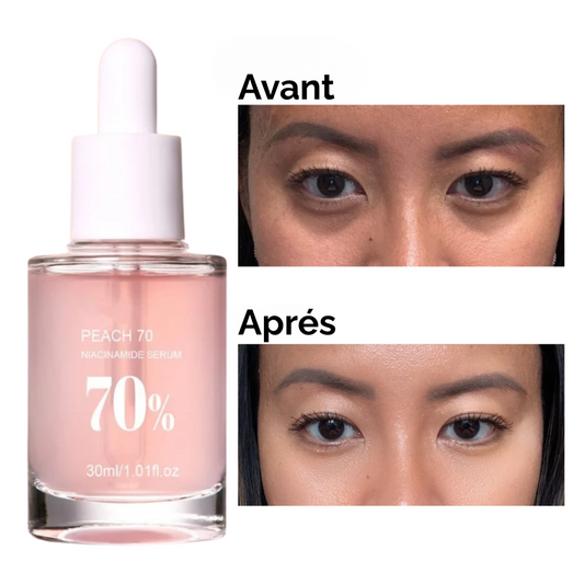 Sérum Niacinamide Pêche 70