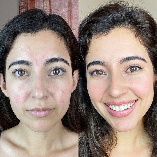 Sérum Niacinamide Pêche 70