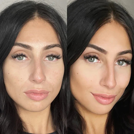 Sérum Niacinamide Pêche 70