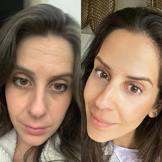 Sérum Niacinamide Pêche 70