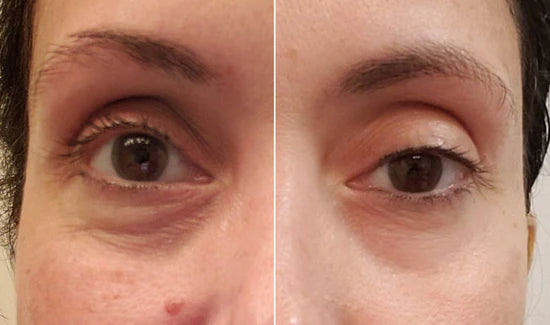 Sérum Niacinamide Pêche 70