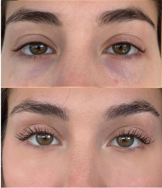 Sérum Niacinamide Pêche 70